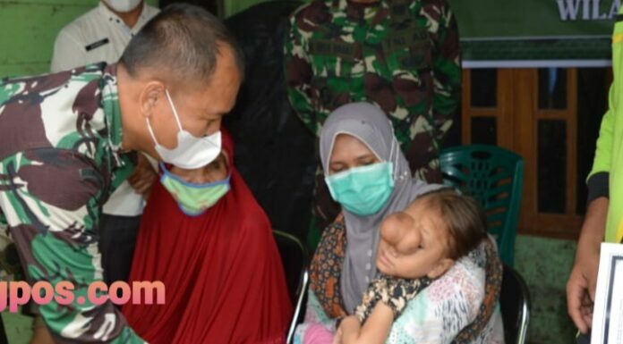 Bakti Sosial Kodim 0212/Tapsel, Bantu Anak Penderita Tumor
