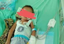 ANAK SIMISKIN MENDERITA PENYAKIT PARU